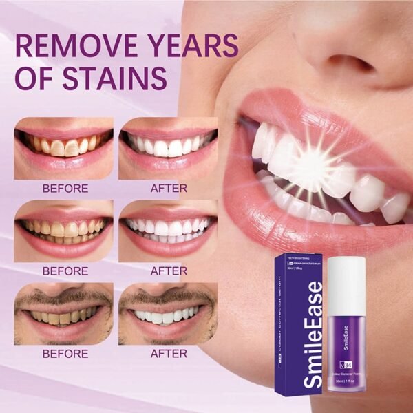 Whitening Tooth Cleansing Mousse | Smiler Kit by DrSmilers - 1 Whitening Tooth Cleansing Mousse | Smiler Kit by DrSmilers - 1
