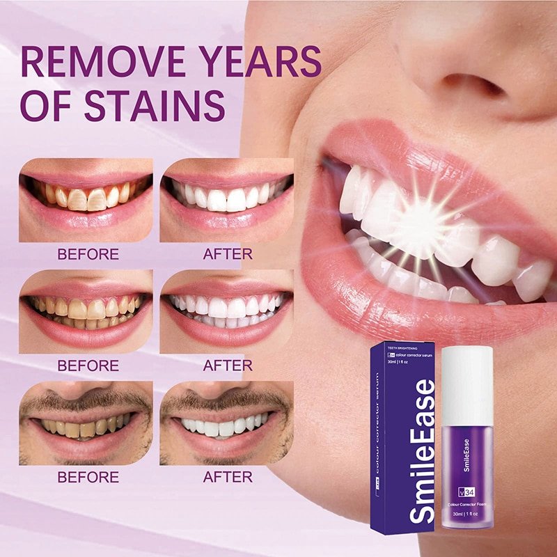 Whitening Tooth Cleansing Mousse | Smiler Kit by DrSmilers - 1