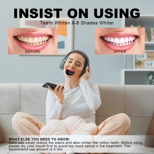 Rechargeable LED Teeth Whitening System | SmileKit by DrSmilers - 6 Rechargeable LED Teeth Whitening System | SmileKit by DrSmilers - 6