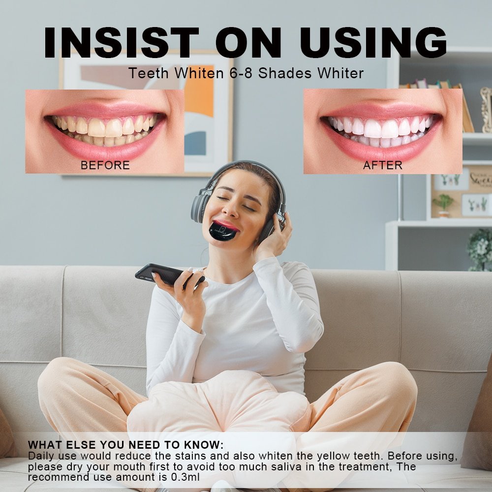 Rechargeable LED Teeth Whitening System | SmileKit by DrSmilers - 6